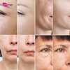 Ems Facial Machine Anti Aging Pluselift