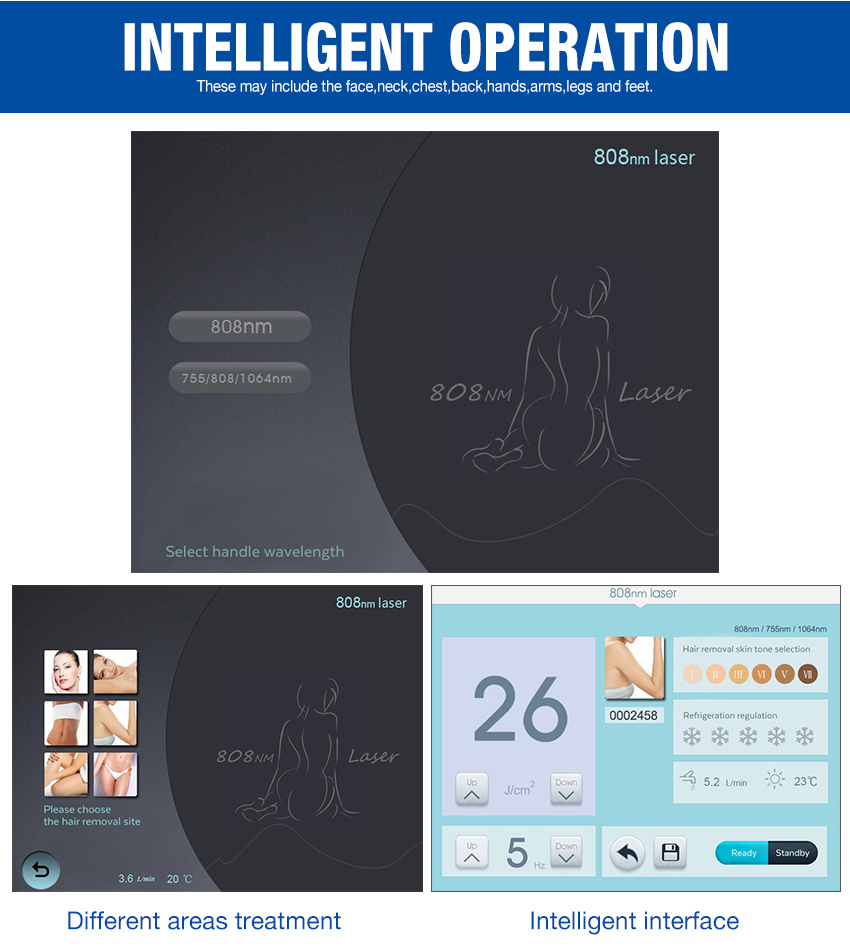 810 diode laser for hair removal 1200w machine touch screen 