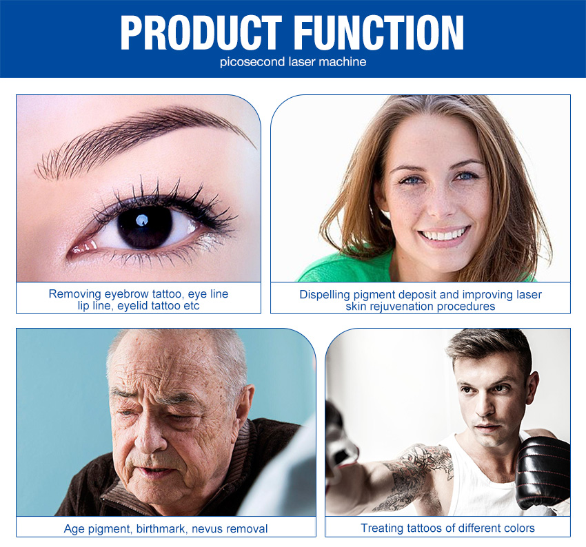 laser tattoo removal machine function