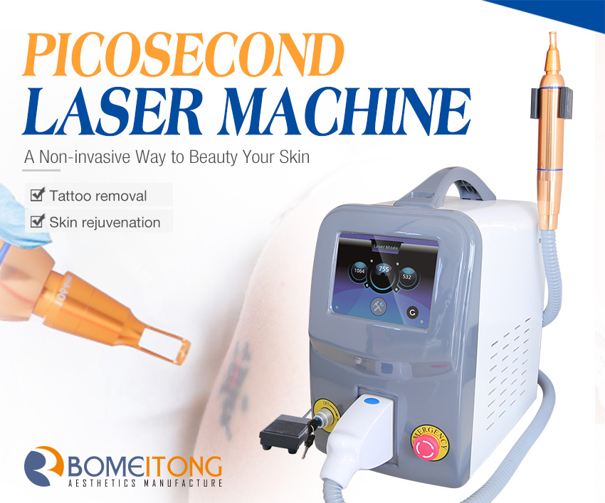 laser tattoo removal machine