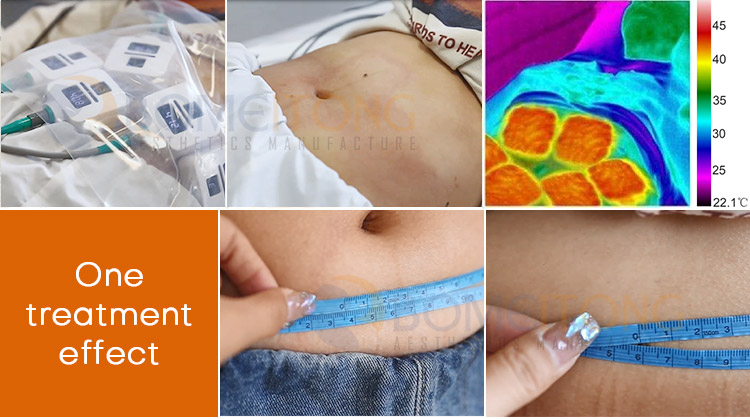 Best muscle building machine body building id flex portable