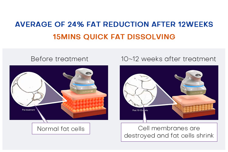 Best muscle building machine body building id flex portable