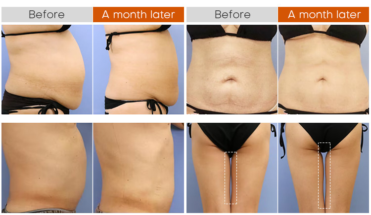 Best muscle building machine body building id flex portable