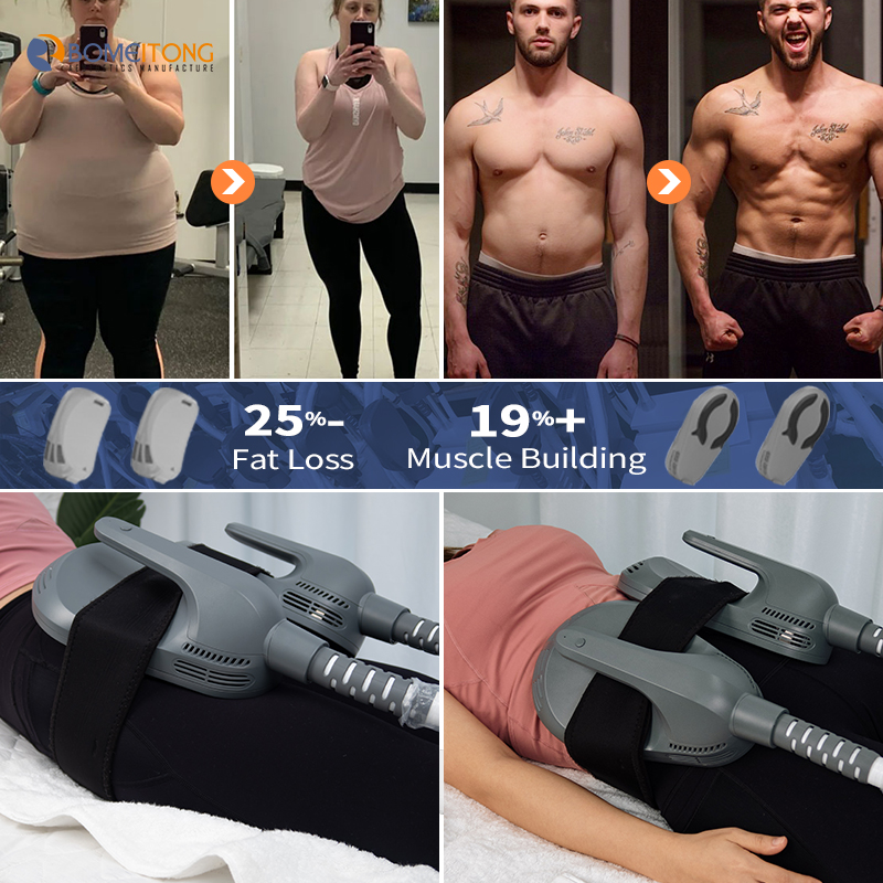 Emsculpt Pelvic Floor Muscle Repair Muscle Machine Build Exercises emsculpt-pelvic-floor-muscle-repair-muscle-machine-build-exercises