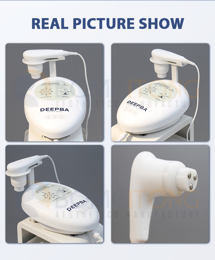 Dermo Electro Poration skin firming ion vibration device Dermoelectroporation