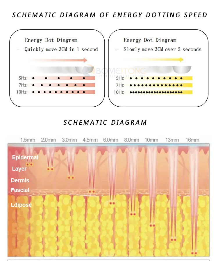 Best Ice Hifu Machine Professional 360&deg; +Lipo +Vaginal Hifu 5 In1