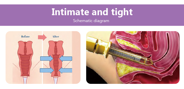 portable co2 fractional laser machine