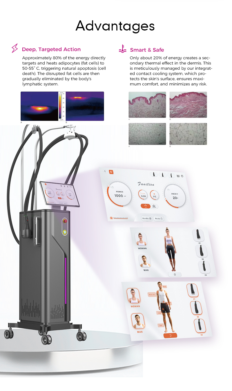 Microwave Cellulite Removal Equipment RF7.0