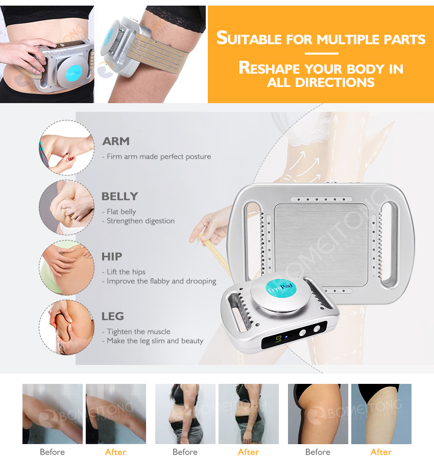 Portable Mini Fat Freezing Cryolipolysis Body Slimming Machine