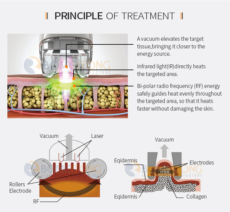 RF lifting cavitation facial cellulite roller massage body slimming shaping machine