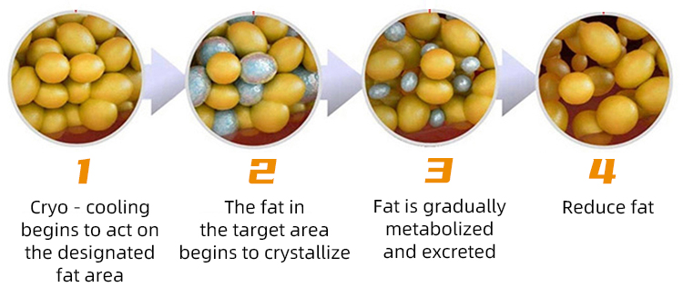 Ems Cryo Pads Machine Body Sculpting 8pcs Flat Cryolipolysis