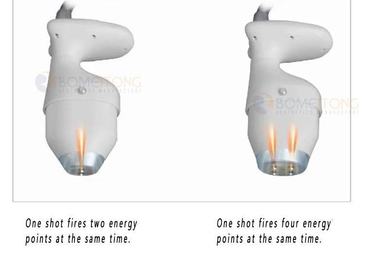 Best Ice Hifu Machine Professional 360&deg; +Lipo +Vaginal Hifu 5 In1