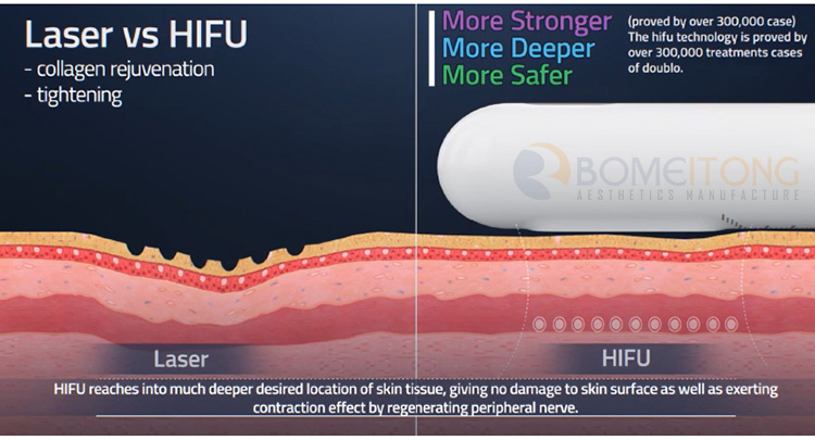 6 in 1 Vertical 360&deg;vignal Hifu Lipo Machine for Sale