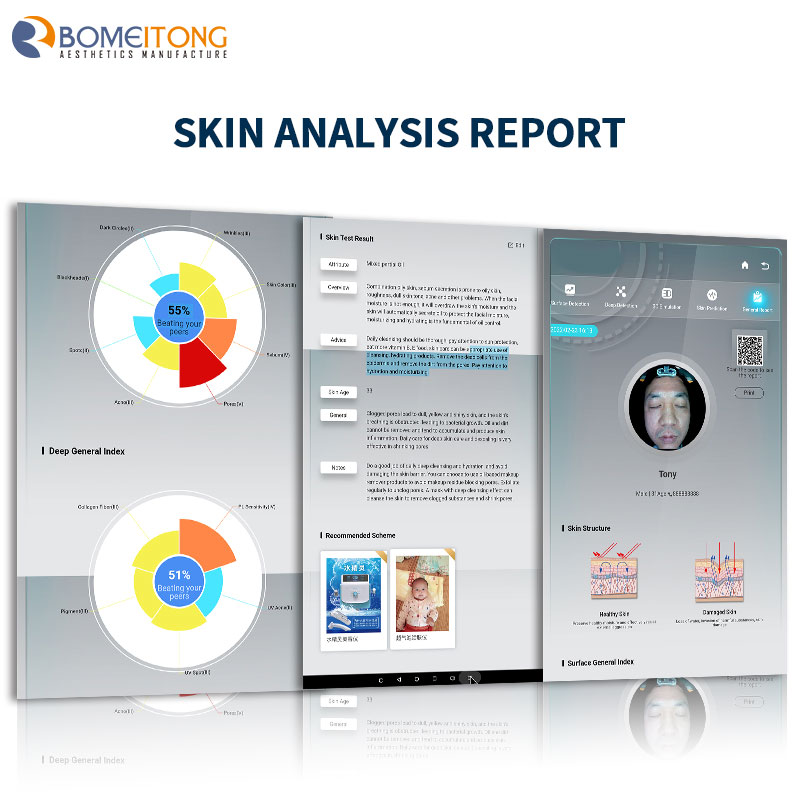 Skin moisture analyzer portable device pores acne 3D simulation technology
