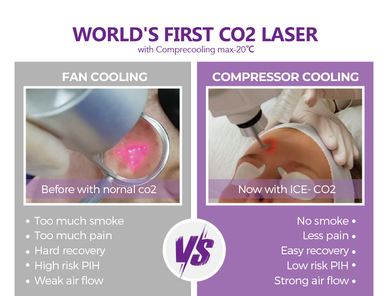 Co2 resurfacing laser machine australia