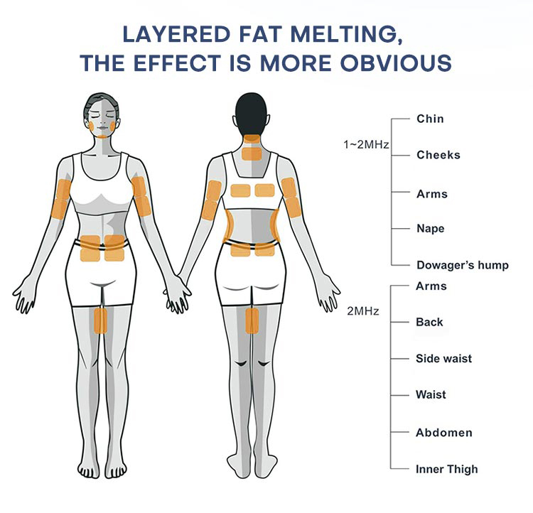 bodysculpt machine radio frequency skin tightening