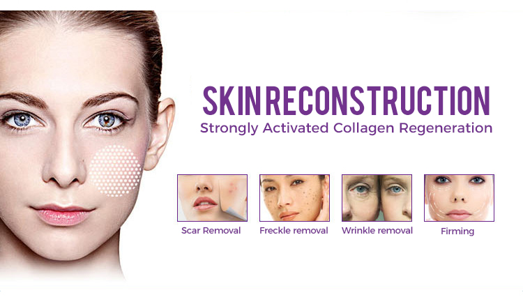 portable co2 fractional laser machine