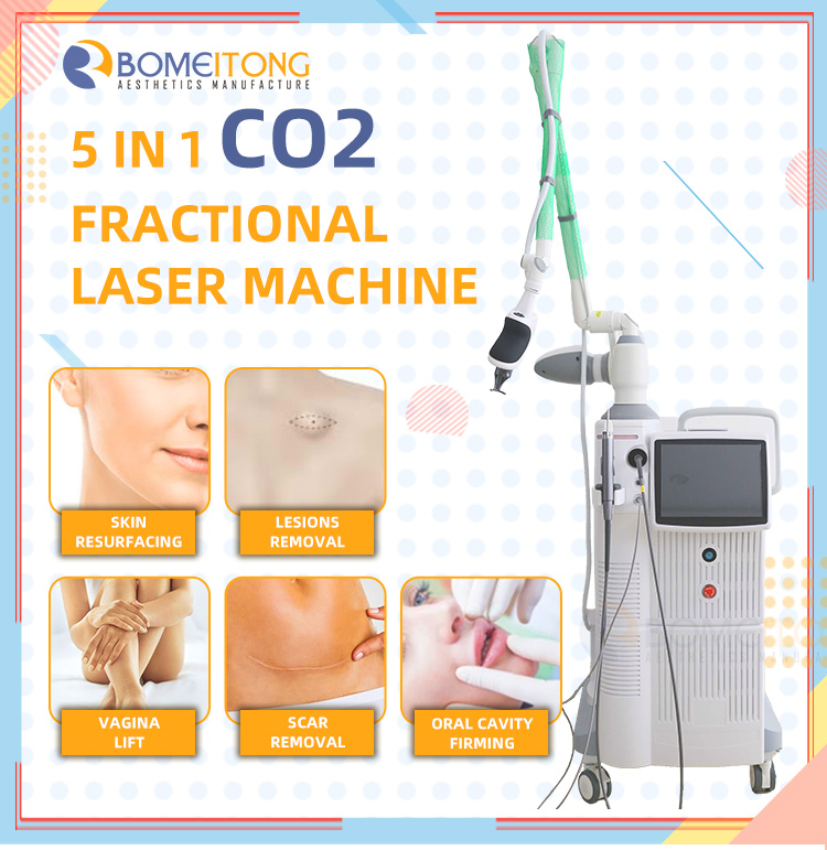CO2 Fractional Laser Machine for Scar Removal And Vagina Tightening BMFR08