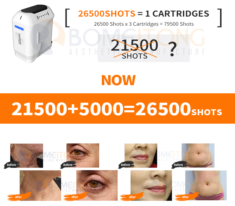 3d Hifu Facial Machine for Face Lifting And Weight Loss