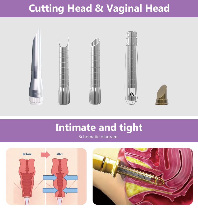 Co2 resurfacing laser machine australia