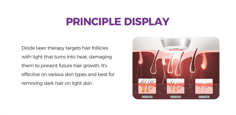 Diode laser portable laser hair removal machine