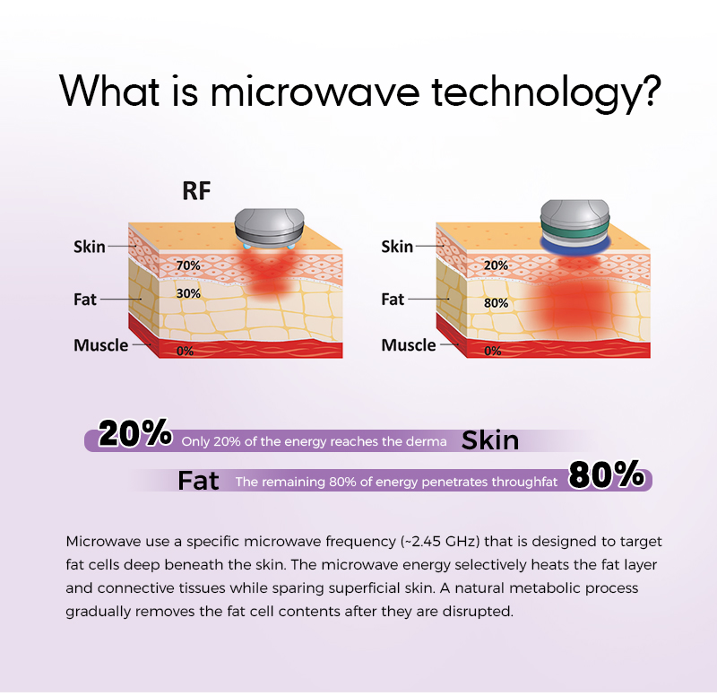 Microwave Cellulite Removal Equipment RF7.0