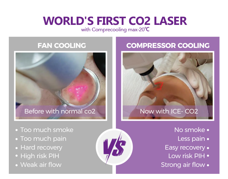 portable co2 fractional laser machine