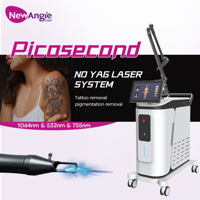 Best Laser Tattoo Removal Technology