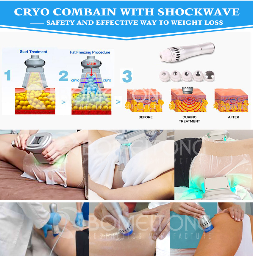 Cryo cellulite new arrival physical therapy shockwave for sale