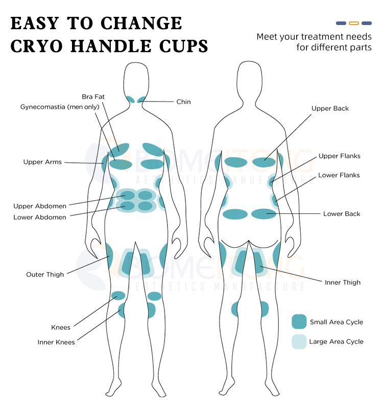 Professional fat freezing machine reduce cellulite removal slimming skin tightening