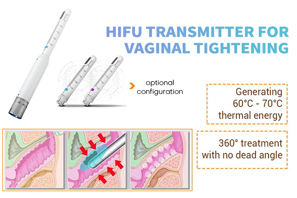 Vaginal Hifu