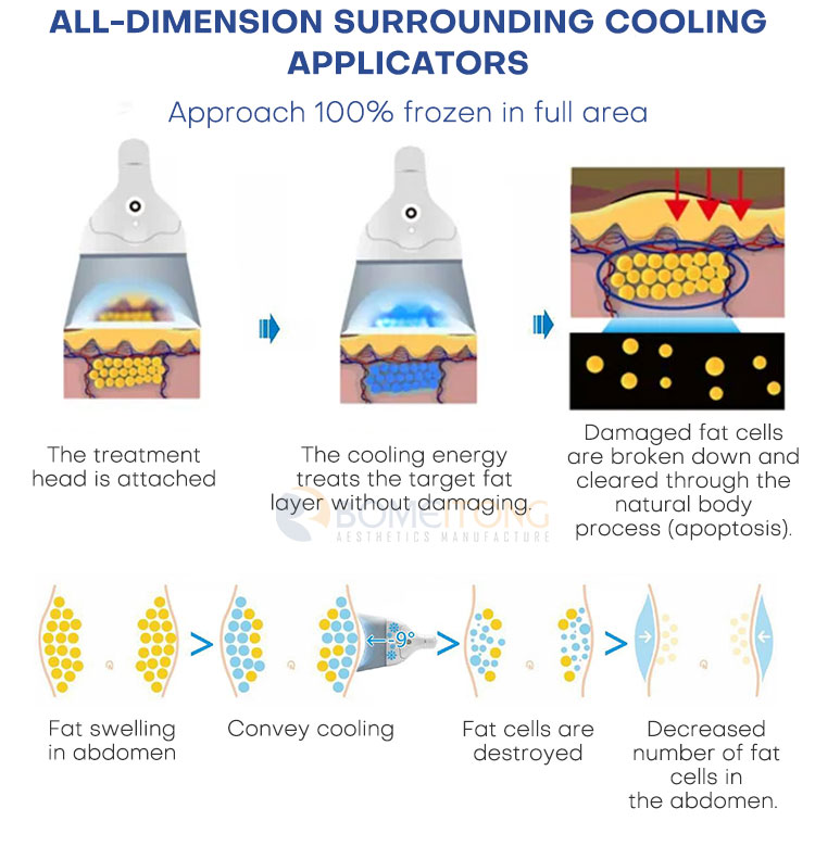 360&deg; Cryolipolysis Fat Freezing Machine for Sale