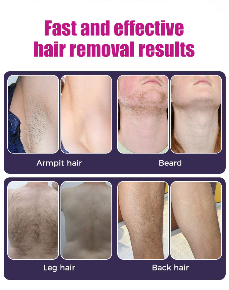 Diode Laser Hair Machine Professional BM051