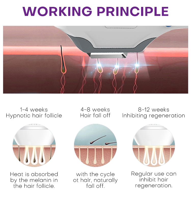 shr hair removal machine