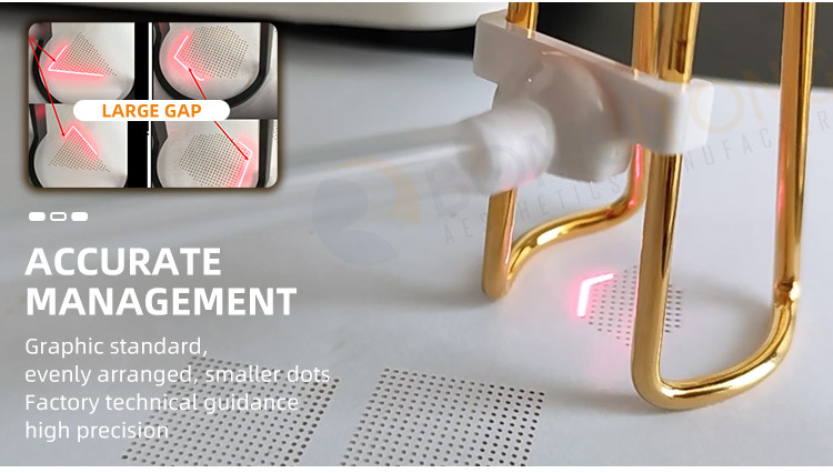 Fractional laser co2 skin resurfacing machine vaginal tightening tatoo acne scar removal