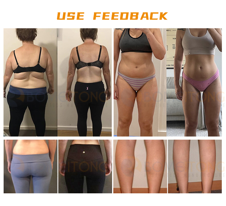 Ems Cryo Pads Machine Body Sculpting 8pcs Flat Cryolipolysis