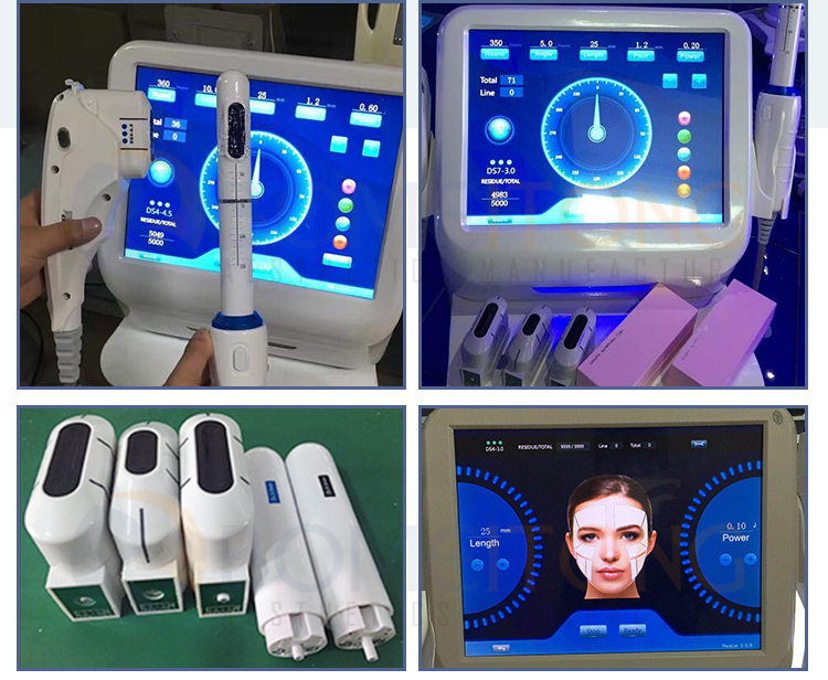 HIFU Vagina Tightening Machine with Facial Lift HIF3-3S