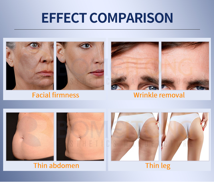 HIFU Vagina Tightening Machine with Facial Lift HIF3-3S