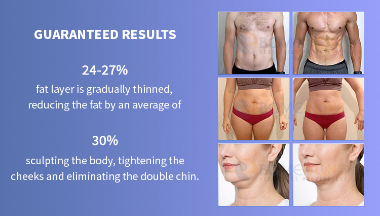 Professional Body Sculpting Equipment for Sale