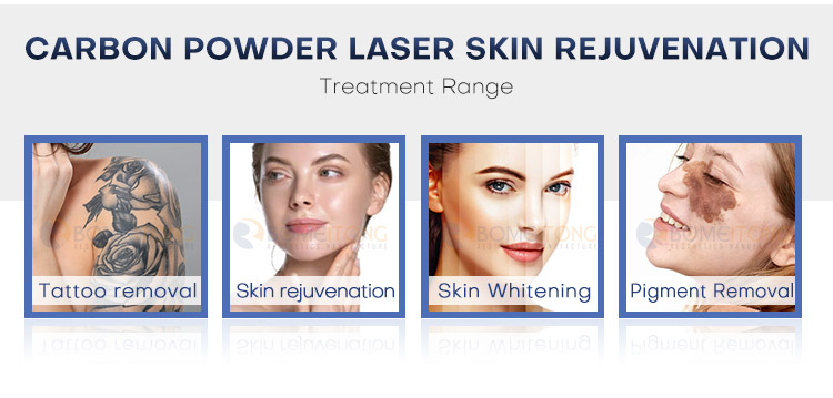 laser removal tattoo machine