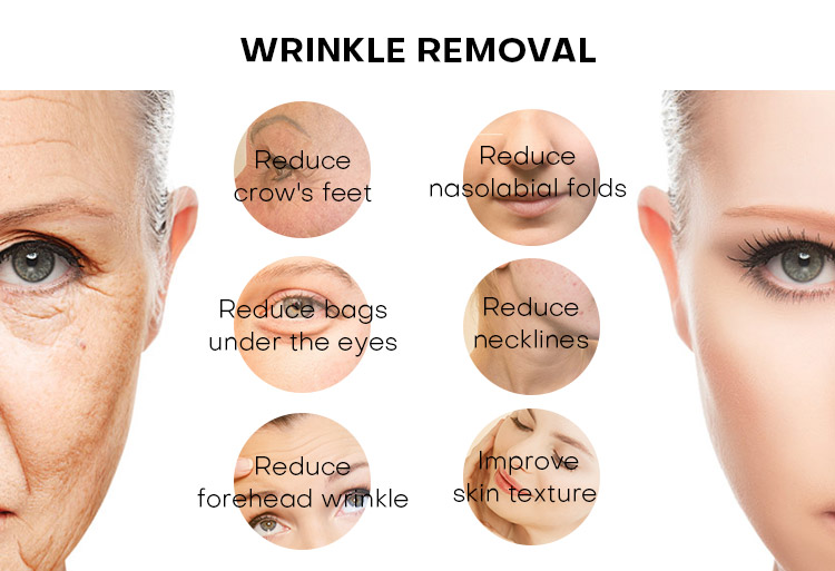 Best Ice Hifu Machine Professional 360&deg; +Lipo +Vaginal Hifu 5 In1