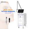 Best Laser Tattoo Removal Equipment