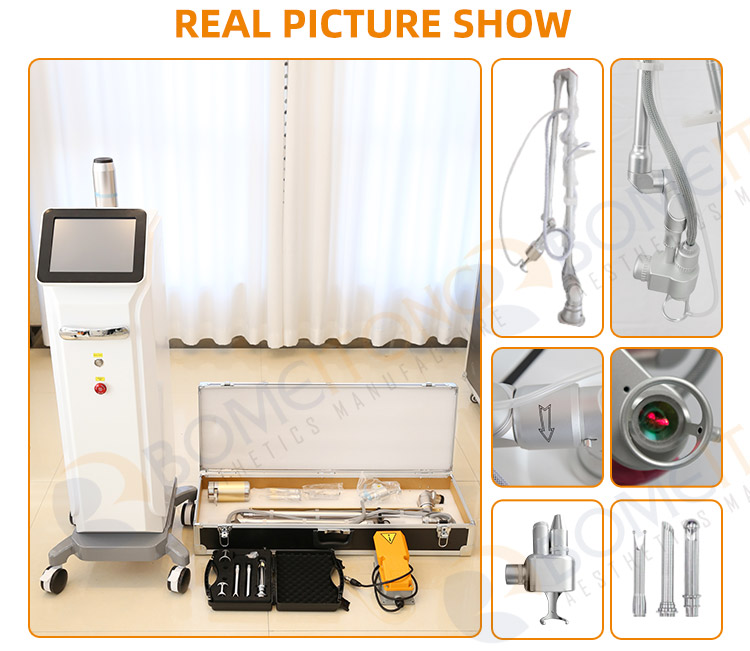 laser fractional co2 medical stretch mark removal skin rejuvenation 10600nm Facial Resurfacing Wrinkles Removal 