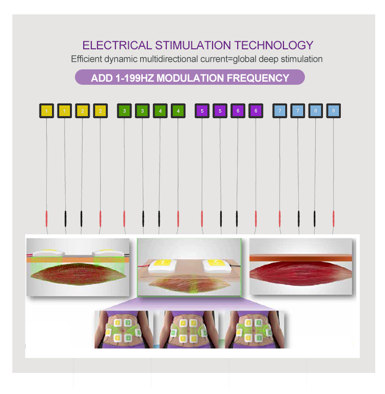 Youshape Machine RF Shaping for body and face