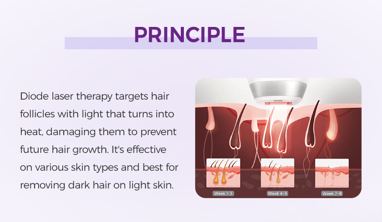 1200W Android Screen Laser Hair Removal Machine