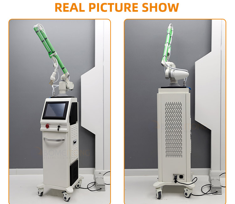 Fractional laser co2 skin resurfacing machine vaginal tightening tatoo acne scar removal
