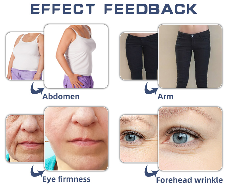 Vacuum therapy machine Fat rotating butt lift rf equipment EMS finger (5)