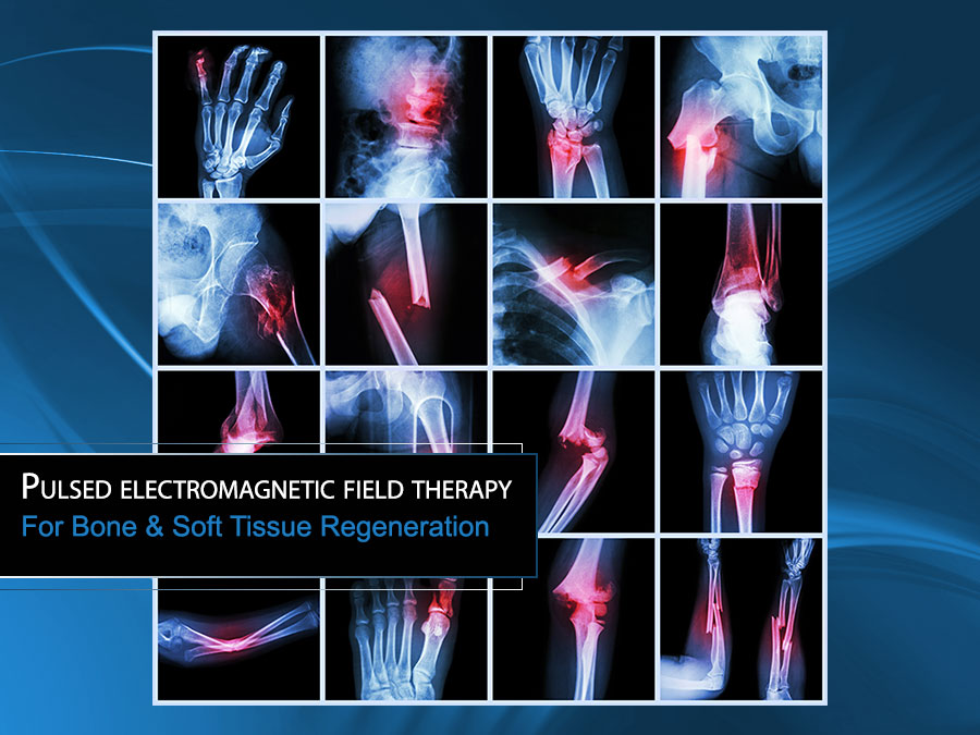How much does pulsed electromagnetic field therapy cost