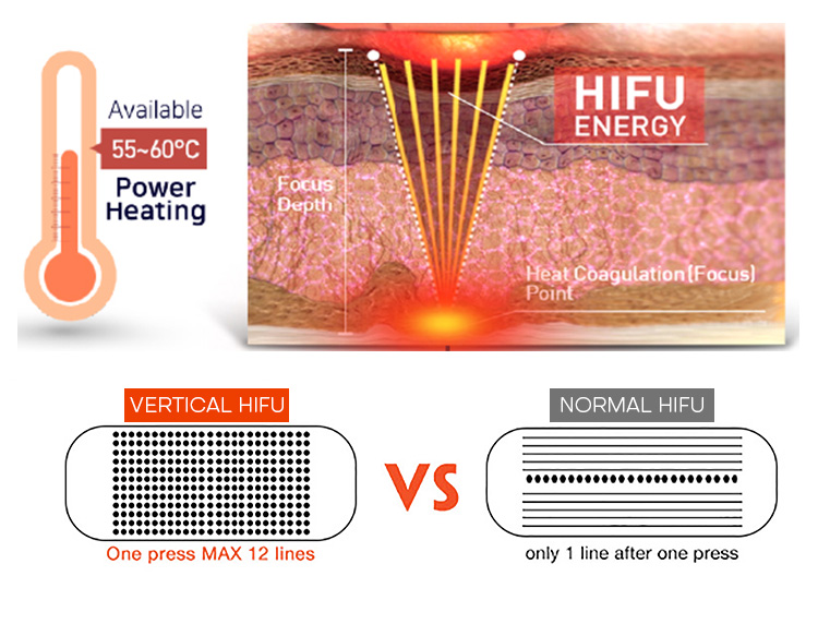 6 in 1 Vertical 360&deg;vignal Hifu Lipo Machine for Sale