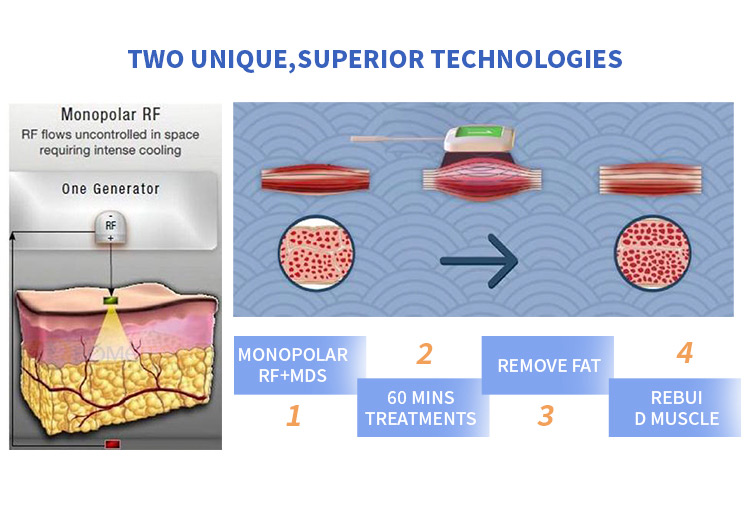 Professional Body Sculpting Equipment for Sale